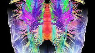 Actividad en el cerebro